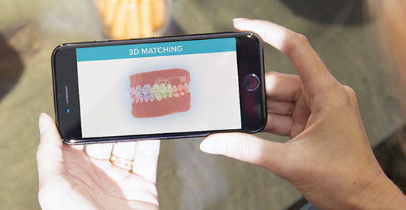 Dental Monitoring Dental Monitoring